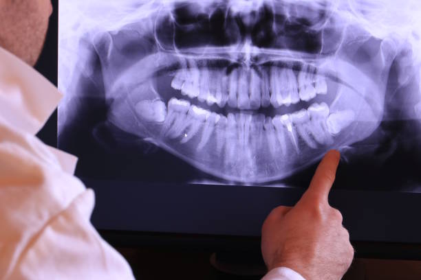 Best Walk-In Emergency Dentist in Keys, OK