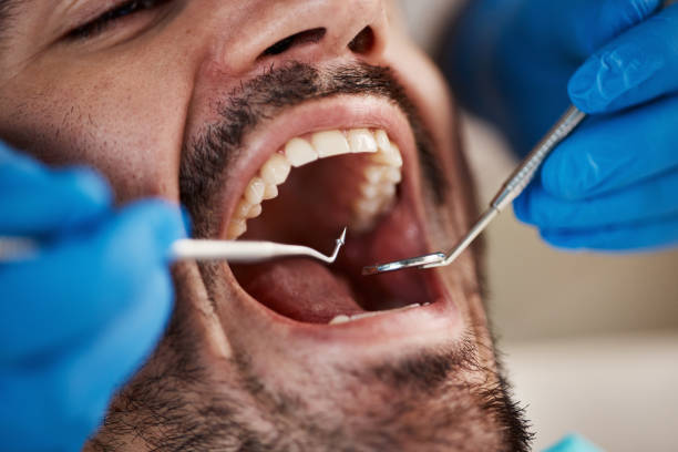 Best Pediatric Emergency Dentist in Keys, OK